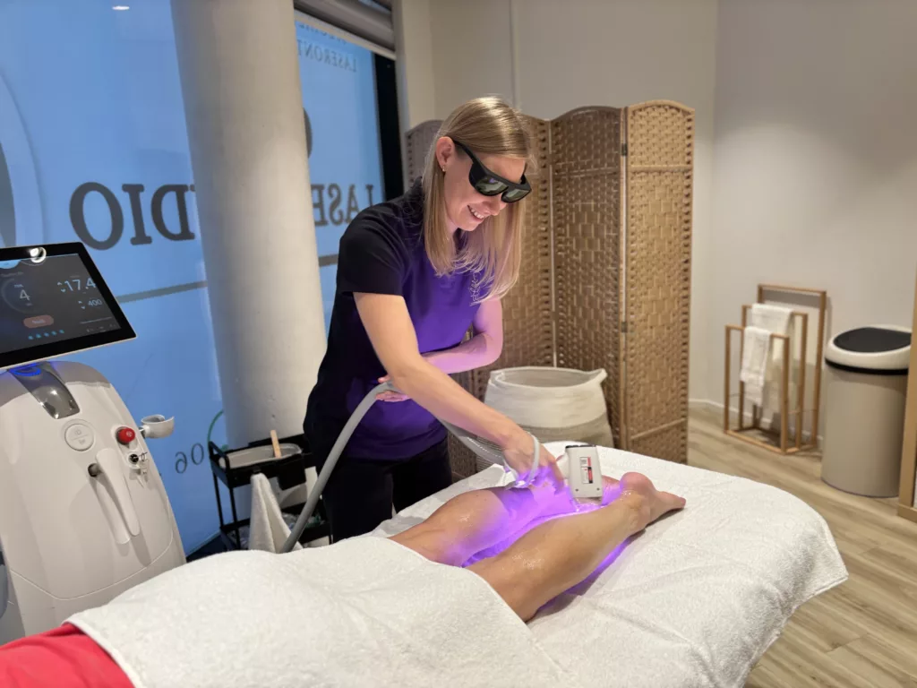Benen laser ontharen Estaro